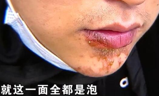 陳赫火鍋店賢合莊發道歉聲明,天花板掉落砸傷顧客