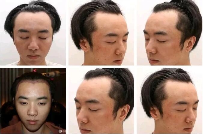 爆料華晨宇整容植發者公開道歉,華晨宇方稱拒絕造謠者道歉